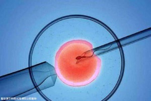 关于私人同性代怀助孕怎么收费